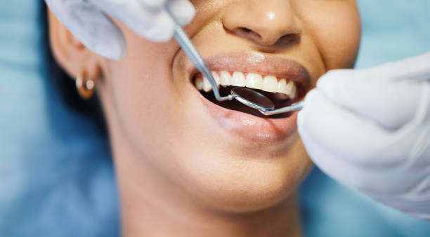 Best Emergency Dentist for Lost Fillings or Crowns in Oakwood, PA